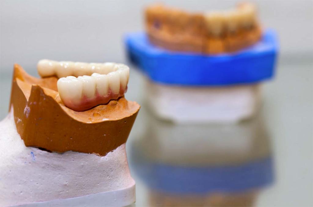 Protez Diş Vurmasına Ne İyi Gelir?