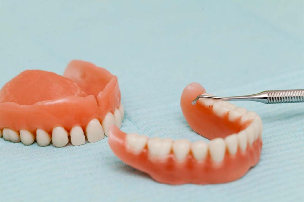 Damaksız Diş Protezi